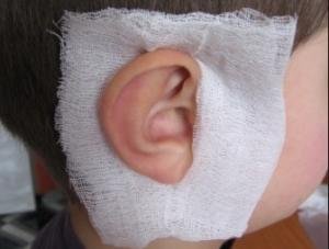 Як лікувати застуджені вуха у дитини в домашніх умовах