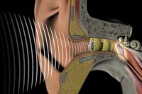 Як і чим лікувати баротравми вуха: методи лікування та профілактики