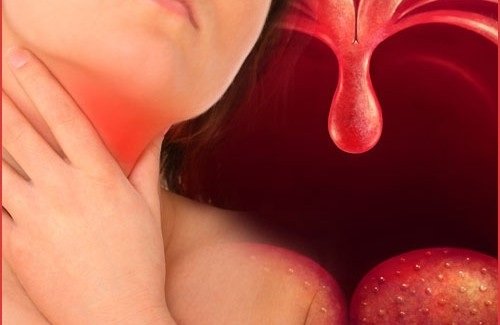 Чому виникає запалення горла і як її лікувати?