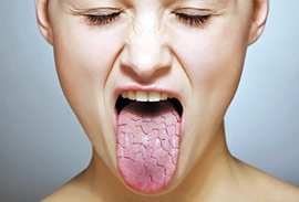 Від чого зявляється сухість у роті?
