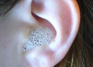 Чим і як правильно промити вуха в домашніх умовах