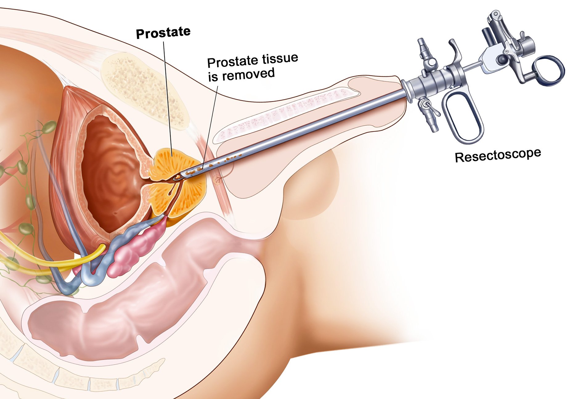 Що таке простата?