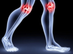 Хрускіт в колінах: опис, причини, лікування та профілактика