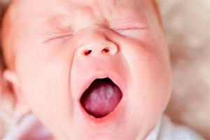 Молочниця у немовлят – основні симптоми і способи лікування