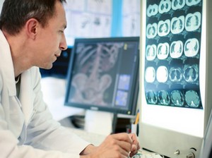 Системне захворювання мозку: діагностика, лікування, рекомендації