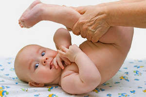 Фізіологічна та патологічна водянка у новонароджених дітей