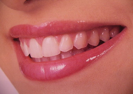 Відбілювання зубів: плюси і мінуси процедур