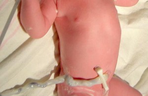 Догляд за пупком немовляти — поради молодим батькам