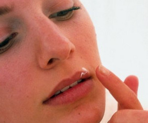 Методи боротьби з заїдами на губах