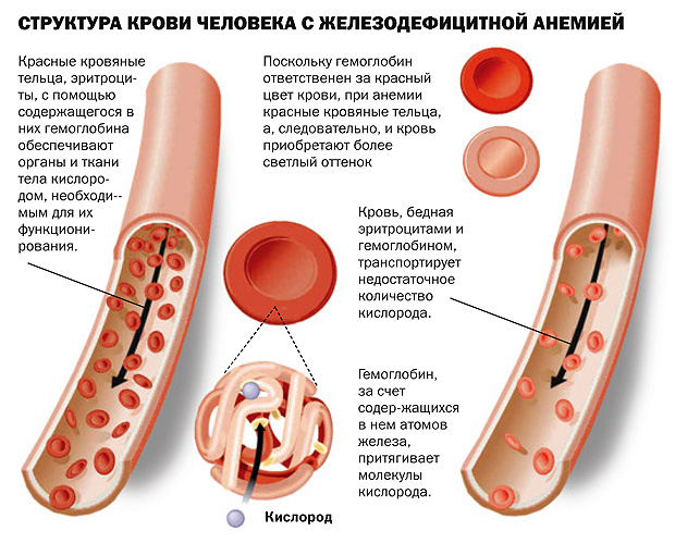 Анемія: ознаки захворювання і його народне лікування