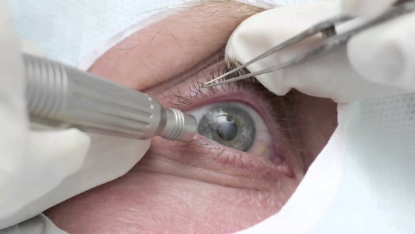 Стовбурові клітини допоможуть повернути зір сліпим людям