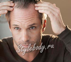 Випадання волосся у чоловіків   причини та засоби лікування