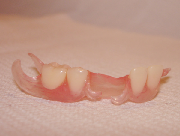 Переваги і недоліки знімних зубних протезів