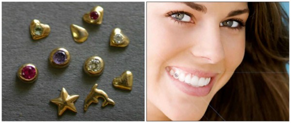 Інкрустація зубів — сучасні прикраси для діамантової усмішки