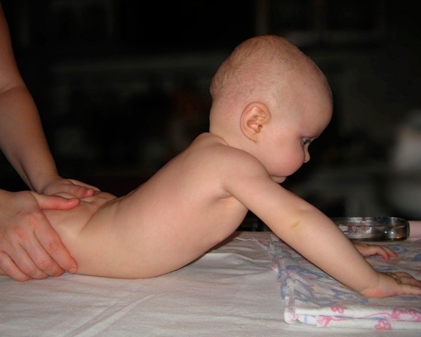 Симптоми і лікування рахіту у немовлят