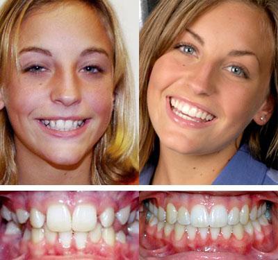 Стоматологічні послуги як основа гарної усмішки