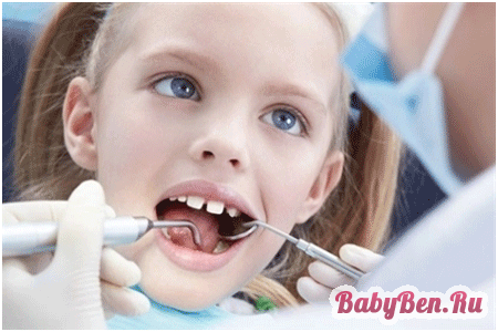 Карієс дитячих зубів