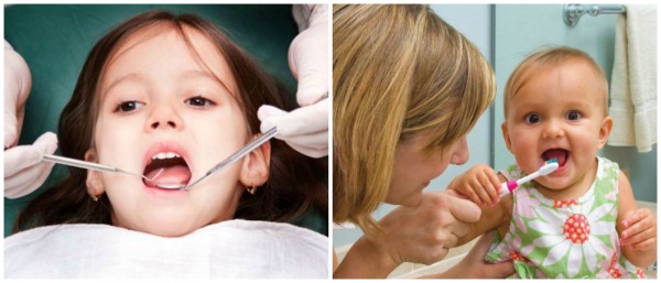 Сріблення молочних зубів у дітей