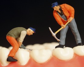Домашні методи відбілювання зубів: плюси і мінуси