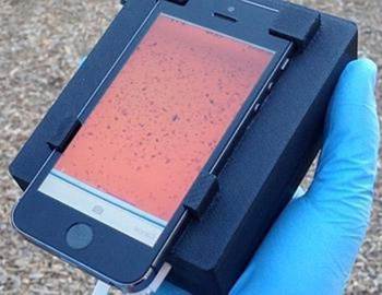 Мікроскоп в мобільному телефоні виявляє паразитів в крові
