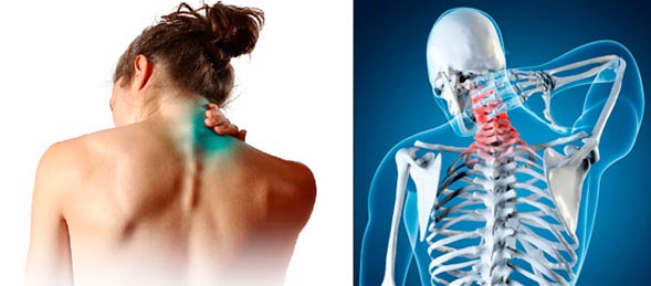 Біль у шиї ззаду ліворуч або праворуч — розбираємося, чому виникає біль