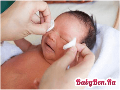 Лікування конюнктивітів у новонароджених дітей