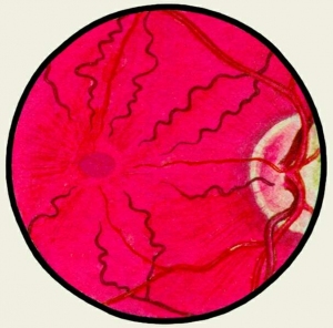 Ангіопатія сітківки ока: ознаки, типи і лікування
