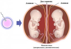 Особливості пізньої вагітності