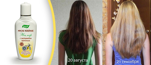 Зміцнення волосся репяхову олію — ефективні способи лікування