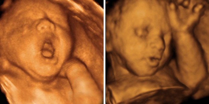 26 тиждень вагітності: що відбувається з мамою, болю і розвиток плоду