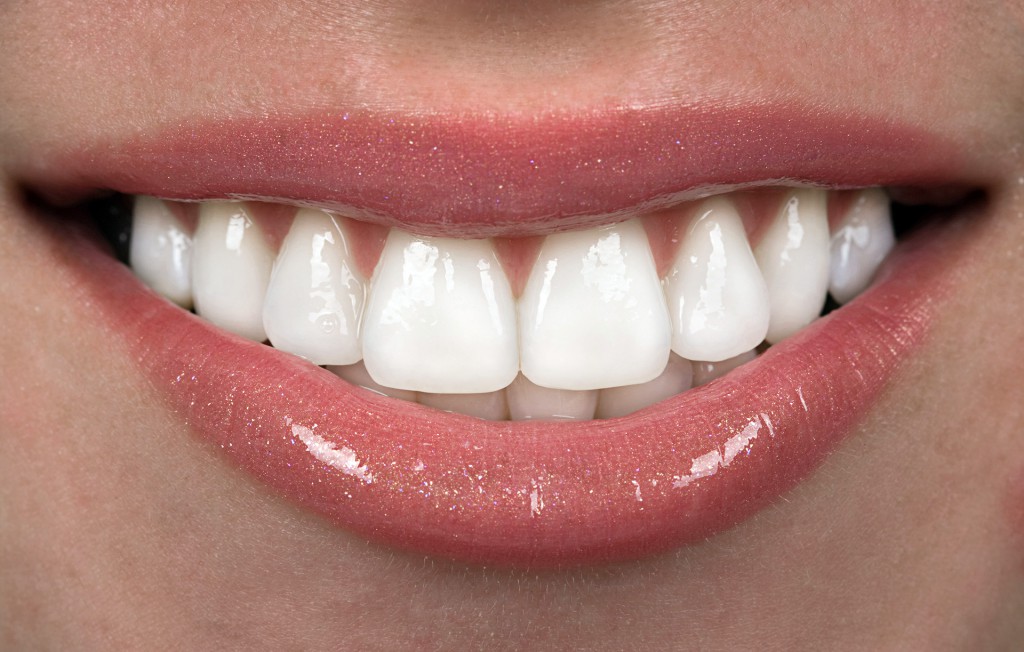 Що таке вініри — плюси і мінуси винирования зубів