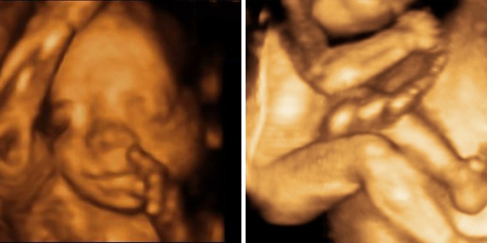 23 тиждень вагітності: що відбувається з малюком, розвиток і ворушіння плода