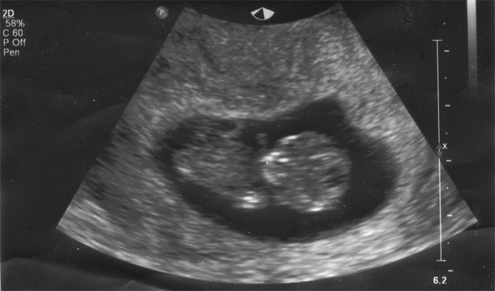 10 тиждень вагітності: що відбувається з мамою і малюком, розвиток плода