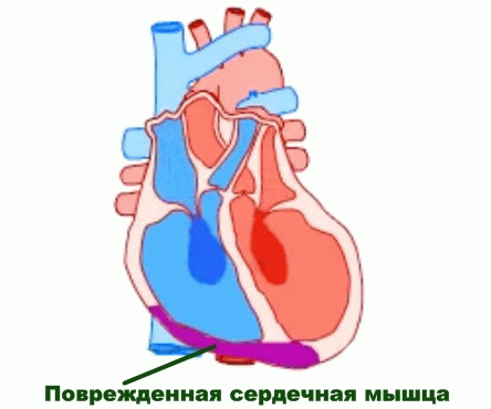 Лікування серцевої недостатності народними засобами, рододендрон