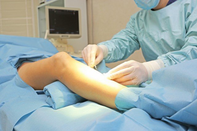 Профілактика варикозу вен на ногах: найбільш ефективні методи