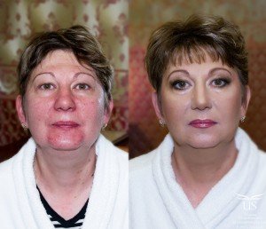 Ліфтинг макіяж: омолоджуючий ефект для вікового особи