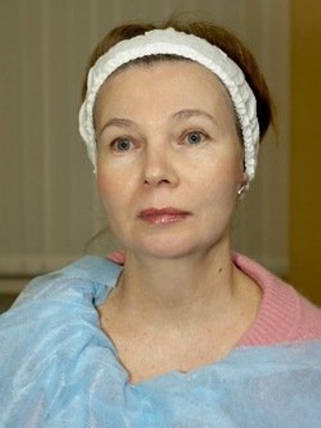 Домашні маски для обличчя від зморшок