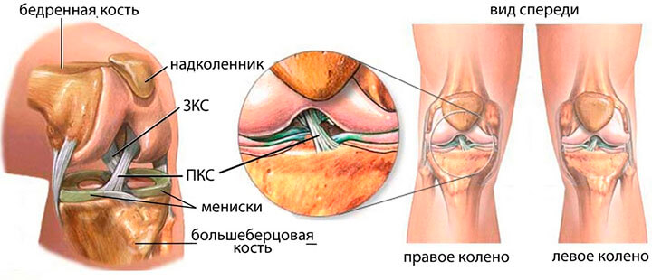 Розрив звязувань колінного суглоба – ознаки, перша допомога та діагностика