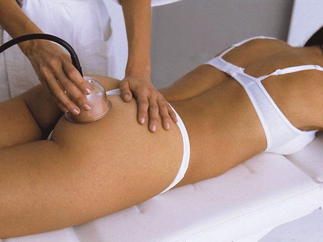 Антицелюлітний масаж банками: як правильно робити?