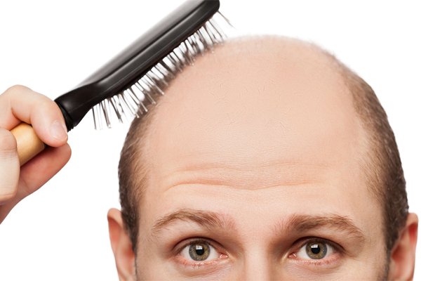 Як лікувати випадання волосся?