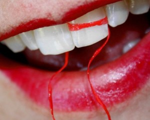 Відбілювання зубів в домашніх умовах, безпечні засоби