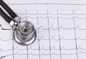 Лікування серця в Ізраїлі: позитивні відгуки пацієнтів