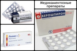 Що таке гіпертонія