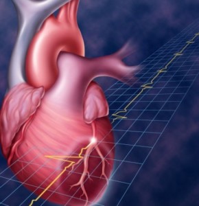 Поширені наслідки інфаркту серця