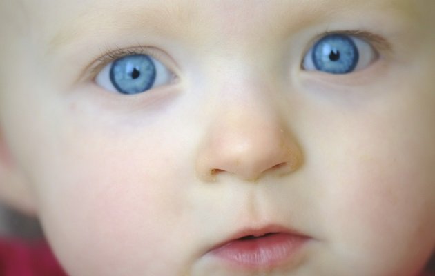 Синці під очима у дитини   як вилікувати темні кола під очима у грудничка