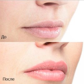 Татуаж губ: фото до і після загоєння і опис процедури