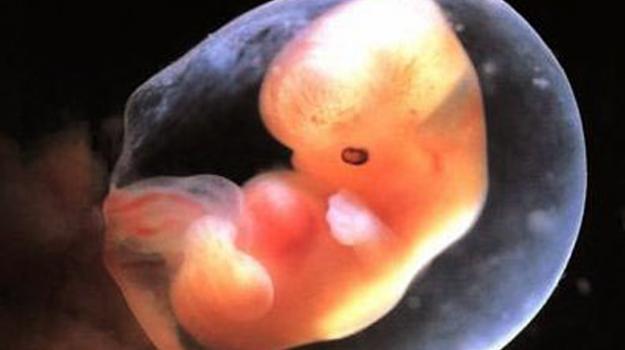 Відшарування плаценти небезпечно для життя малюка