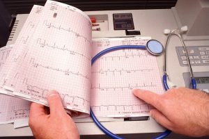 Аритмія серця: лікування медикаментами і народними засобами