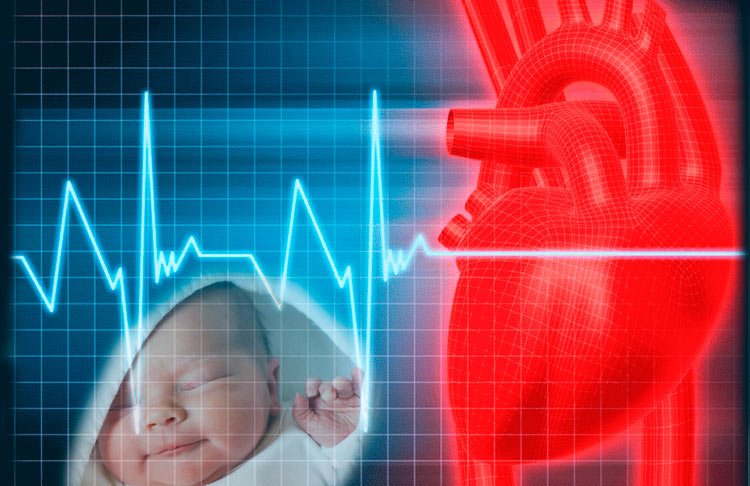 Вроджений порок серця: причини, симптоми, лікування