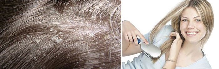 Сім процедур лікувального процесу для оздоровлення волосся